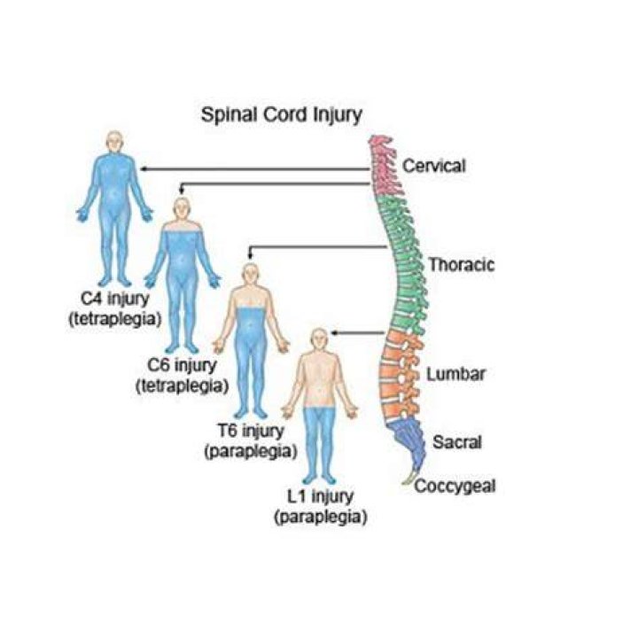 Is a spinal cord injury fatal?