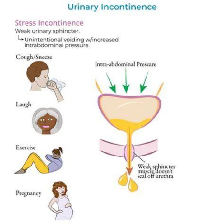 Why does childbirth cause incontinence?